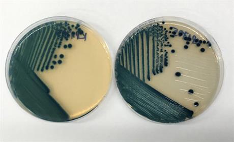 Chẩn đoán sớm nhiễm khuẩn bằng đĩa thạch ChromAgar CRE sản xuất trong nước