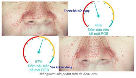 Serum trẻ hoá da từ protein tái tổ hợp